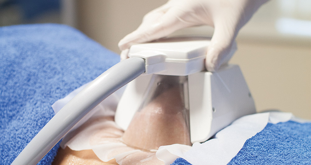 How Fat Freezing and HIFU Work Together? 2 Multiple Areas in One Session HIFU and Fat Freezing Northwich