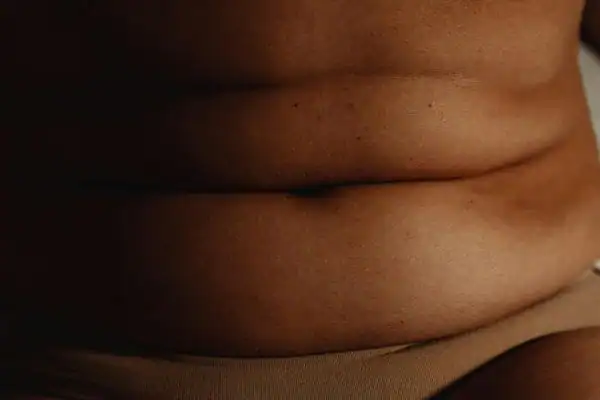 The Hidden Connection: How Stress Shapes Your Fitness and Body Composition 3 image of what stress can do on the stomach area and how Lipo 360 Northwich can help to change your body shape.